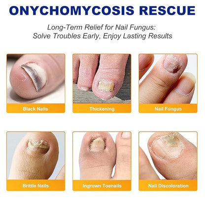 Toenail Fungus Treatment Extra Strength,32 Pcs Nail Patches for Nail Treatment Overnight, Nail Repair for Damaged Nails, Nails Care Supplies, Restore Discoloration and Thickness