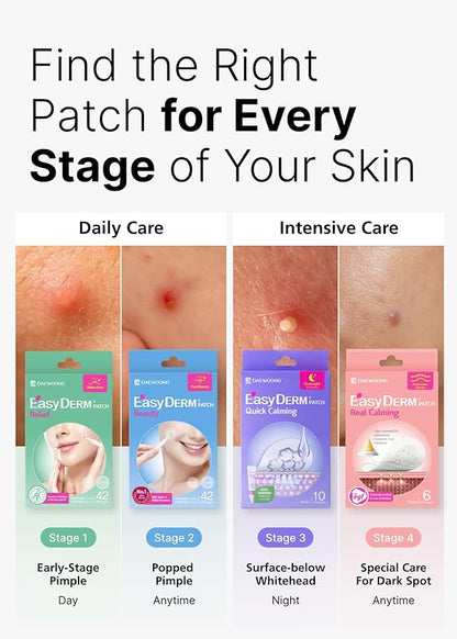 EasyDerm Multi-Step Pimple Patch Set – 4-Type Korean Pimple Patches + Free 2-in-1 Dual-Tip Extractor for Complete Skincare