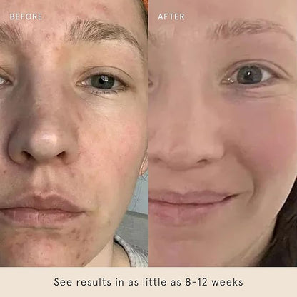 Barefaced Glow Peel Pads (60 Count) - Deep Exfoliating Face & Body Pads with 15% Glycolic Acid, Squalane & Vitamin E - Smooths Texture, Reduces Breakouts & Fine Lines