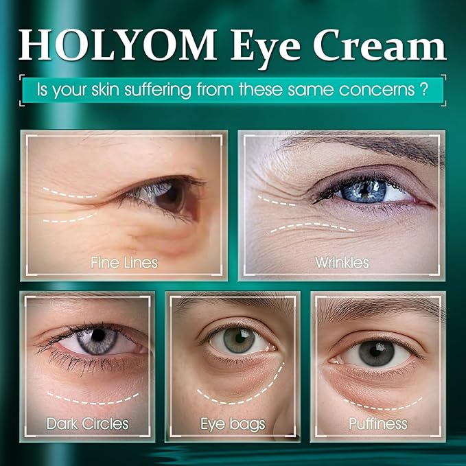 Retinol Eye Cream for Dark Circles & Puffiness - Anti-Aging Treatment with Hyaluronic Acid, Reduces Eye Bags, Wrinkles & Fine Lines | Hydrating Under Eye Care for Women & Men (1 fl oz)