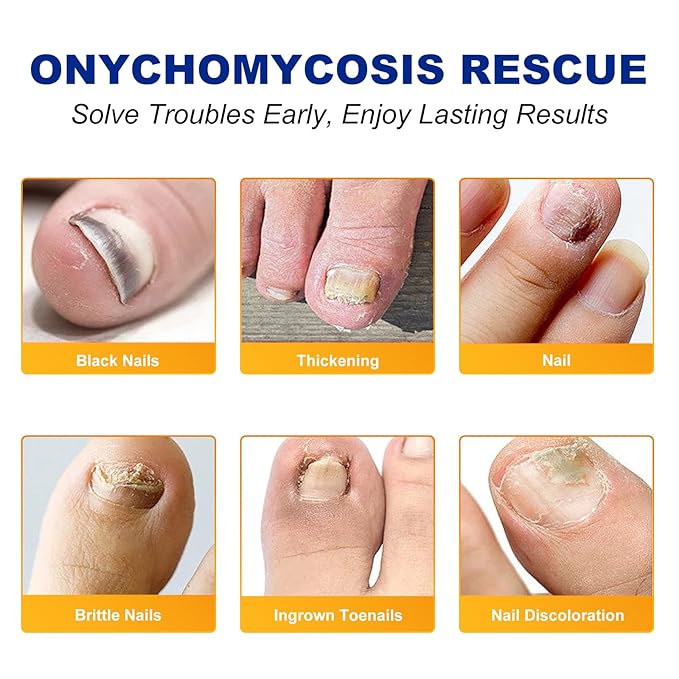 64 pcs Toenail Treatment Extra Strength-8-Hrs Overnight Nail Repair,ingrown toenail treatment,Strengthens Brittle Nails,Improves Texture & Thickening Hypoallergenic Easy