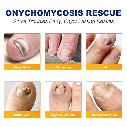 64 pcs Toenail Treatment Extra Strength-8-Hrs Overnight Nail Repair,ingrown toenail treatment,Strengthens Brittle Nails,Improves Texture & Thickening Hypoallergenic Easy