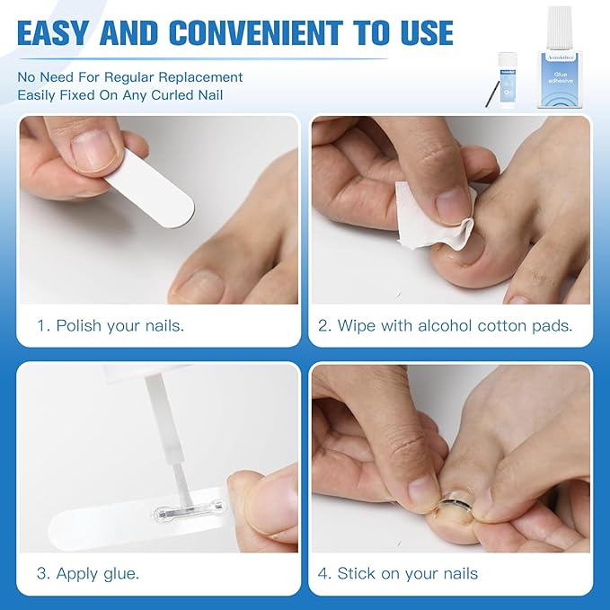 Titanium Alloy Ingrown Toenail Treatment, Ingrown Toenail Removal Kit for Curved Nail Repair, Ingrown Nail Tool for Home Use