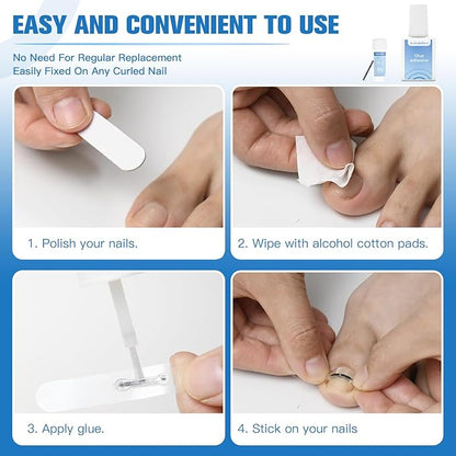 Titanium Alloy Ingrown Toenail Treatment, Ingrown Toenail Removal Kit for Curved Nail Repair, Ingrown Nail Tool for Home Use