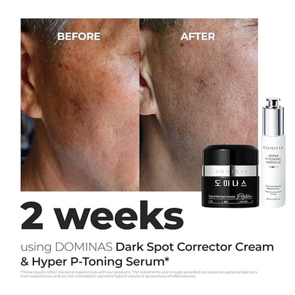 DOMINAS Dark Spot Corrector Cream | Advanced Formula with Niacinamide, TXA, Hexylresorcinol & Bakuchiol to Visibly Reduce Age Spots, Sun Spots & Uneven Tone | Korean Skincare (1.76 oz)