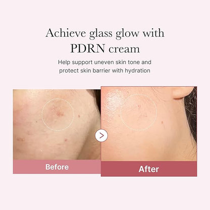 medicube PDRN Pink Hyaluronic Moisturizing Cream | Blemish Recovery, Relief & Hydrating Care | Restores Skin Elasticity & Glow | Korean Skincare for Even Skin Tone & Pore Care | 50ml / 1.69 fl.oz.