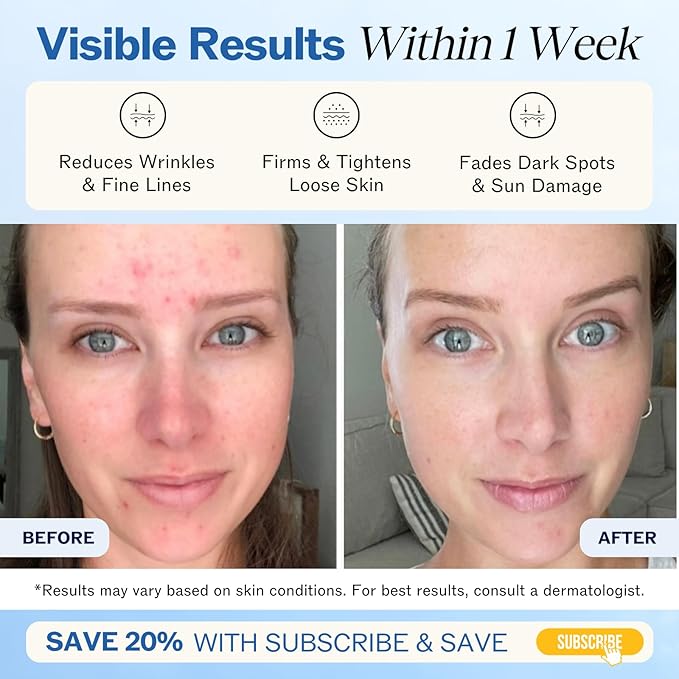 LilyAna Naturals Anti Aging Retinol Face Cream for Women – Wrinkle & Neck Cream for Firming, Retinol Moisturizer for Face with Hyaluronic Acid, Hydrating Night Cream for Fine Lines, Collagen Boost