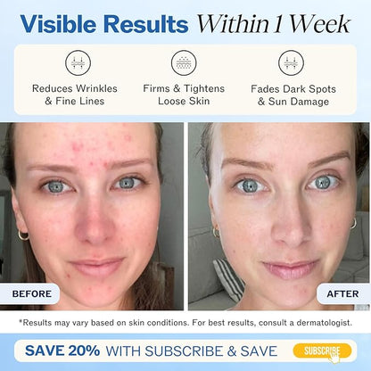 LilyAna Naturals Anti Aging Retinol Face Cream for Women – Wrinkle & Neck Cream for Firming, Retinol Moisturizer for Face with Hyaluronic Acid, Hydrating Night Cream for Fine Lines, Collagen Boost
