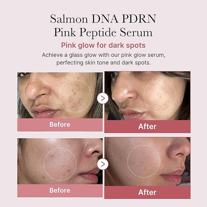 medicube Intensive Moisture & Skin Plumping Set: Salmon DNA PDRN Pink Peptide Serum and Salmon DNA PDRN Pink One Day Serum