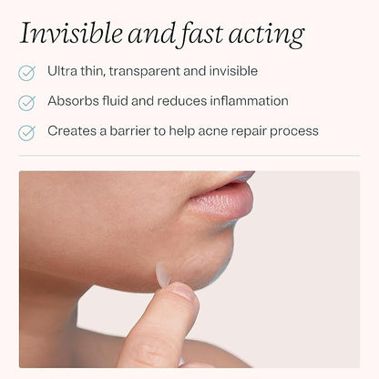 MDacne Pimple Patches for Acne Treatment, Hydrocolloid Patches - Absorbs Oil & Pus from Clogged Pores, Ultrathin & Transparent Blends with All Skin Tones, Safe for Sensitive Skin (36 Patches)