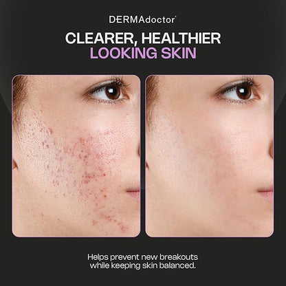 DERMAdoctor Sulfur Acne Treatment - Clay Mask & Acne Spot Treatment | Face Mask Blackhead Remover - Bentonite Clay Detox | Non-Irritating Non-Drying Calming & Soothing with Natural Exfoliants - 2.3 Oz