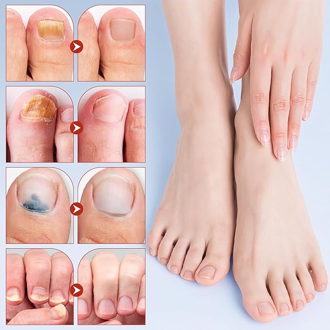 21Pcs Toenail Treatment Extra Strength - Nighttime Nail Patches, Nail Treatment Patches, Overnight Toe Nail Treatments for Damaged Nails Foot Nails Repair and Care