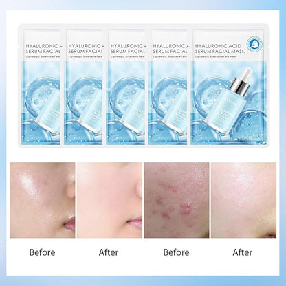 Facial Masks Skincare for Women,Salicylic Acid Moisturize Face Mask Sheet for Girl,Hydrating Face Mask for All Skin Types,Dry Skin & Sensitive Skin(10-Packs)