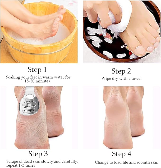 52 Pcs Callus Shaver Set,1 Stainless Steel Foot Razor with 50 Replacement Slices Blades and 1 Foot File Head Foot Care Tools,Foot Shaver Callus Remover,Hard Dry Skin Remover for Hand Feet
