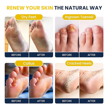 Citrus Detox Foot Soak With Epsom Salts - for Foot Callus, Immune Boost, Damaged Toenail, Athletes Foot, Pedicure and Soothes Tired Aching Feet - Made in USA 16 oz (Pack of 2)