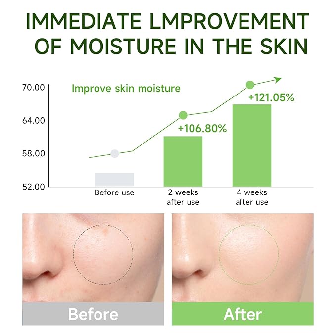 Centella Asiatica Serum Centella Tea Tree Ampoule Facial Serum Korean Centella Serum for Acne-Prone Oil Skin Soothing, Calming, Reduce Redness 105ml