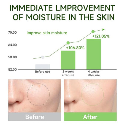 Centella Asiatica Serum Centella Tea Tree Ampoule Facial Serum Korean Centella Serum for Acne-Prone Oil Skin Soothing, Calming, Reduce Redness 105ml