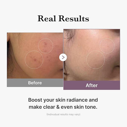 medicube Age-R Glutathione Glow Milky Toner, Low-Irritation Double Layer Toner for Glass Glow Skin with Peptide, Even Skin Tone, Radiance, Hydration, Korean Skincare