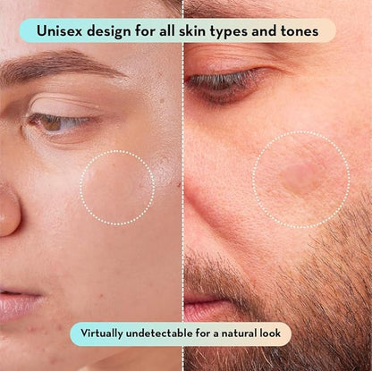 LE GUSHE Korean Pimple Patches for Face (78 Dots) - Hydrocolloid Acne Patches with Tea Tree Oil - Invisible Zit Stickers - Dermatologist Tested - Korean Skin Care