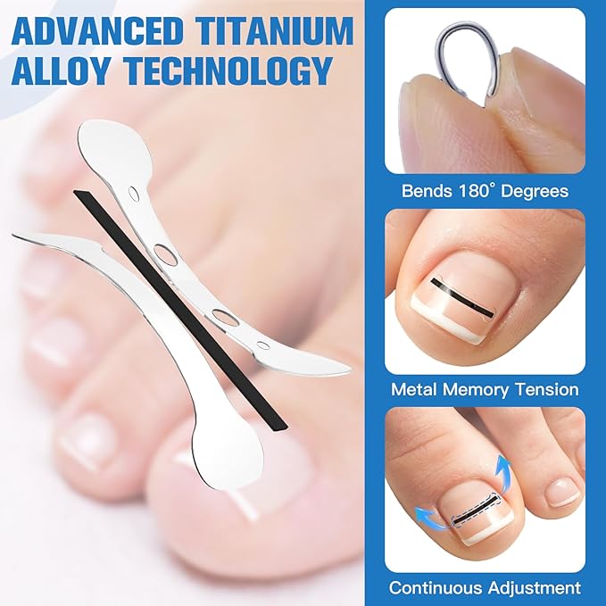 Titanium Alloy Ingrown Toenail Treatment, Ingrown Toenail Removal Kit for Curved Nail Repair, Ingrown Nail Tool for Home Use