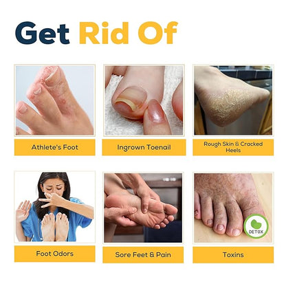 Citrus Detox Foot Soak with Epsom Salts – for Foot Callus, Damaged Toenail Appearance, Pedicure Spa, and Soothing Sore, Tired Feet – Made in USA – 16oz
