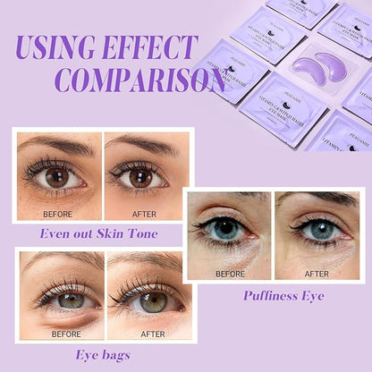 Under Eye Patches with Vitamin C and Witch Hazel Eye Mask for Dark Circles and Puffiness,Face Mask Skin Care Products 30 Pairs