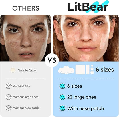 LitBear Large Pimple Patches for Face (6 Sizes 118 Pcs), Big Hydrocolloid Acne Patches, XL Hydrocolloid Bandages for Body, Cheek, Forehead, Chin, Full Face, Back, Nose
