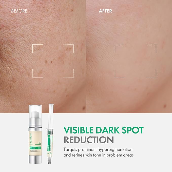 Easydew DW-EGF Melatoning Ampoule 3X - Hydrating Dark Spot Serum with Niacinamide & Glutathione for Uneven Skin - Fast Absorbing Day & Night Ampoule Korean Skin Care (Pump 0.27 fl oz, EGF 3X)