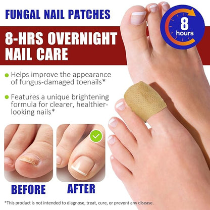 Toenail Treatment Extra Strength, 32 Pcs Nail Patches Overnight Nail Fast Acting Care for Damaged Nails- Visible Results in 8 Hours-Renewal for Men and Women