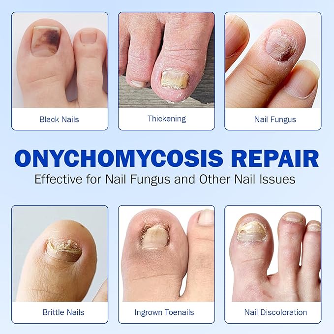 Toenail Treatment Extra Strength 42pcs, Nail patches for Toenails, Overnight Toe Nail Treatments, Nighttime Nail Repair for Thick, Brittle and Discolored Toe Nail, Strengthen Damaged Foot Nails