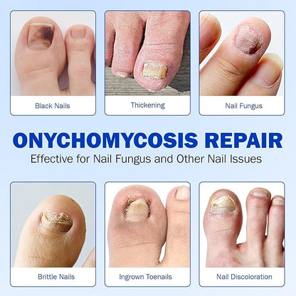Toenail Treatment Extra Strength 42pcs, Nail patches for Toenails, Overnight Toe Nail Treatments, Nighttime Nail Repair for Thick, Brittle and Discolored Toe Nail, Strengthen Damaged Foot Nails