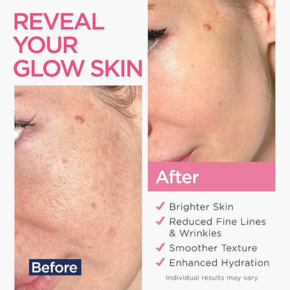 Retinol Serum for Face (8Oz) with Hyaluronic Acid, Vitamin E & Aloe Vera - Anti-Aging Serum