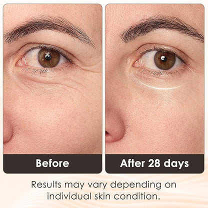 JVV Red Light Therapy for Eyes,Anti-Aging Wrinkle Reduction Dark Circle Remover, 5 Modes therapy mask, Adjustable Strap,Red & Infrared Daily Skin Rejuvenation Christmas Gifts
