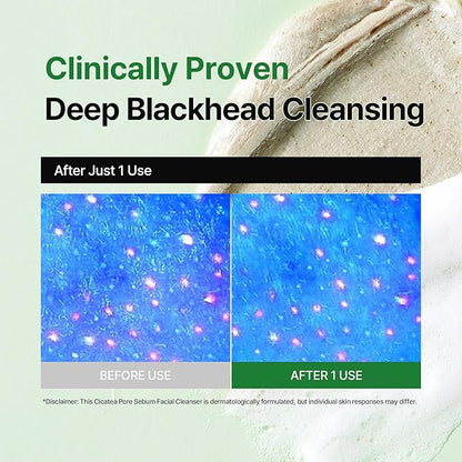 Cicatea Pore Sebum Facial Cleanser, Face Mask, Gentle Scrub, Face Wash with Centella Asiatica Hyaluronic Acid, Blackhead Remover Care, All Skin Types, Korean Skincare (5.07 Fl Oz / 150ml)