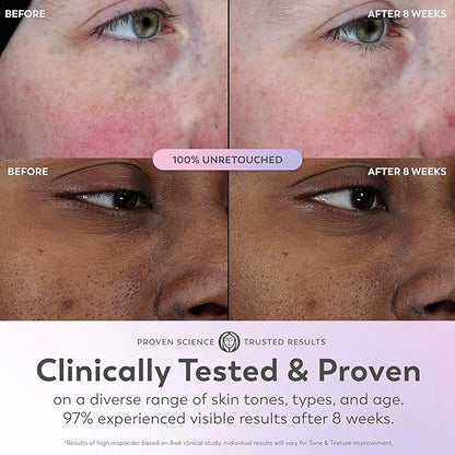 Olay Super Serum - Niacinamide, Vitamin C & E, Collagen Peptide, AHA - 5-in-1 Skin Care Benefits for Face - Healthy Glow, Brightening, Hydrating, Smoothing, Firming, Evens Tone, Anti-Aging, 1.0 Oz