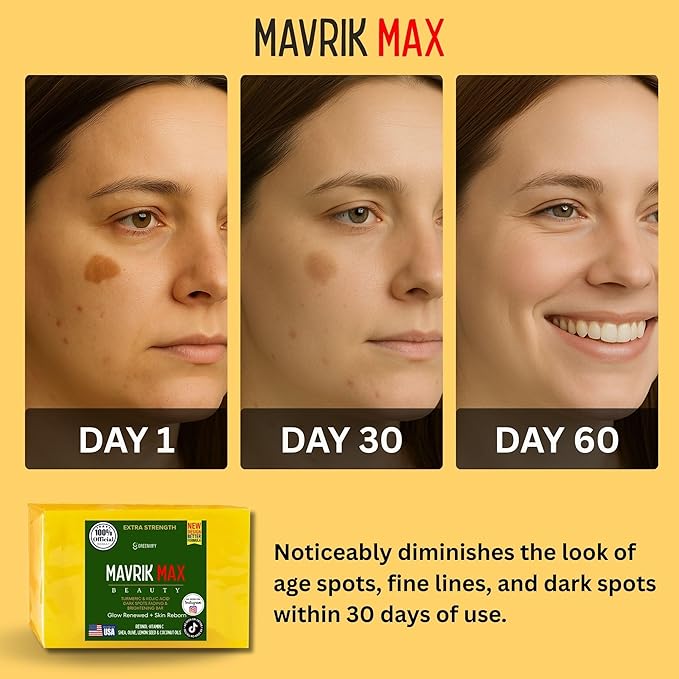 Mavrik Max Beauty Turmeric & Kojic Acid Dark Spots Fading Bar, Extra Strength Formula with Retinol, Vitamin C, Shea Oil, USA Made