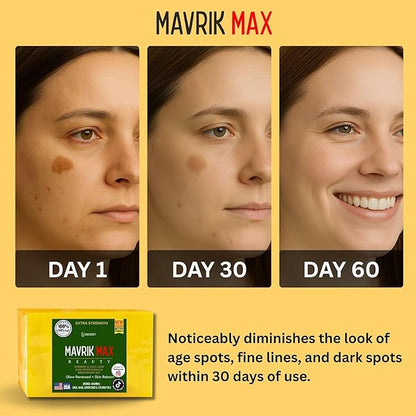 Mavrik Max Beauty Turmeric & Kojic Acid Dark Spots Fading Bar, Extra Strength Formula with Retinol, Vitamin C, Shea Oil, USA Made