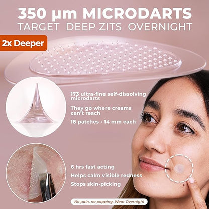 OMMA Korean Microdart Acne Patch, Cystic Acne Treatment, Micropoint Pimple Patches for Face for Early-Stage Painful Zits, Salicylic Acid & Tea Tree - 14 mm Zit Stickers (18 Count)