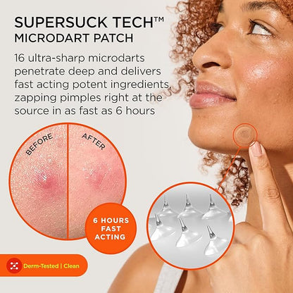 ZitSticka Killa Pimple Patches for Face - World's Most Potent Pimple Patch with Fast-Acting Microdarts - Starts Working within 26 Hours for Deep, Early-Stage Zits - Mini 24 Count