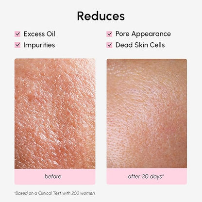 MAREE Pore Minimizer for Face Toner – Witch Hazel Toner with Niacinamide & Marine Collagen – Gentle Exfoliating Oil Control Facial Toner for Women – BHA Liquid Exfoliant – Alcohol Free Tonico Facial