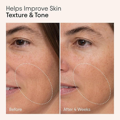 Alpyn Wild Nettle & Niacinamide Firming Serum | Visibly Smooth, Plump, & Moisturize | Reduce the Look of Fine Lines & Pores - For All Skin Types | 1 oz / 30 ml