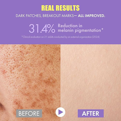 Glutathione Vitamin C Serum 50ml - Step-by-Step Discoloration Correcting Serum with Hyaluronic Acid & Niacinamide - Moisturizing & Hydrating K Beauty Skin Care (1.69 fl oz)