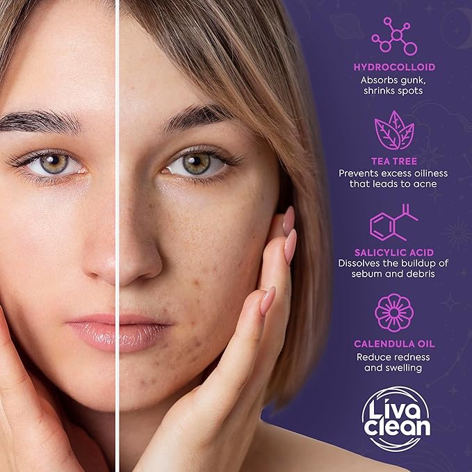 Livaclean 240 CT Star Pimple Patches for Face + 330 CT Acne Patches w/Tea Tree Oil, Salicylic Acid | Hydrocolloid Acne Patch | Cute Star Pimple Patch for Healing Hydrocolloid Patch Zit Stickers
