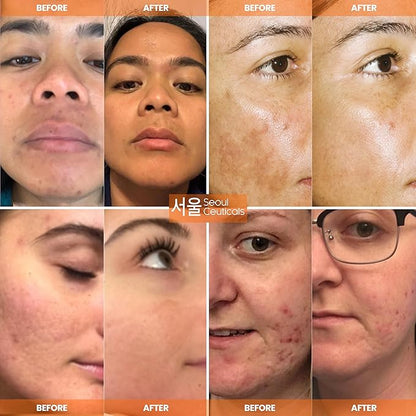 SeoulCeuticals Large 2oz Korean 20% Vitamin C Hyaluronic Acid Serum + CE Ferulic Acid - Potent Anti Aging, Anti Wrinkle K Beauty