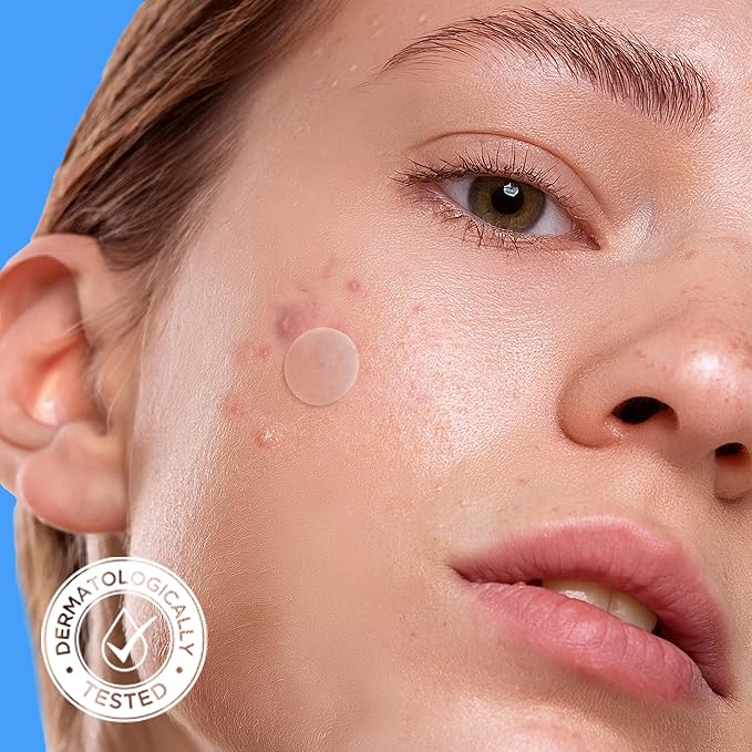 AVARELLE Pimple Patches for Face | Hydrocolloid Acne Patches for Covering Blemishes | Zit Patches with Tea Tree, Calendula, & Cica | HSA Store Eligible Items (10-14 mm, 80 Count)