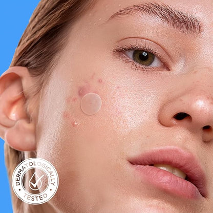 AVARELLE Pimple Patches for Face | Hydrocolloid Acne Patches for Covering Blemishes | Zit Patches with Tea Tree, Calendula, & Cica | HSA Store Eligible Items (10-14 mm, 80 Count)