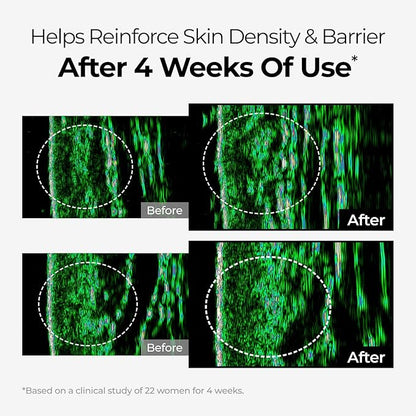 DOMINAS Dark Spot Corrector Cream | Advanced Formula with Niacinamide, TXA, Hexylresorcinol & Bakuchiol to Visibly Reduce Age Spots, Sun Spots & Uneven Tone | Korean Skincare (1.76 oz)