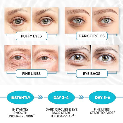 Under Eye Patches for Puffy Eyes, Dark Circles, Dull Skin - Natural Moisturizing Support - Help with Wrinkles and Fine Lines - Under Eye Mask with Hyaluronic Acid, Collagen, Caffeine - 30 Pairs