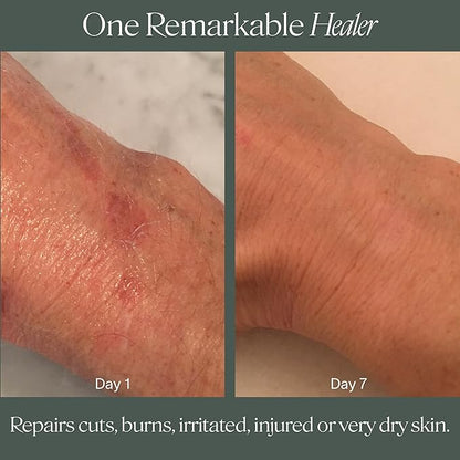 Doctor Rogers Restore Healing Balm. Multi-Purpose Healing Ointment & Moisturizing Eczema Relief Gel. Protects & Soothes Injured, Sensitive & Dry Skin, 1 Ounce (28 g) Jar