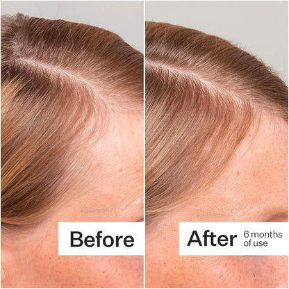 Act+Acre 3-Pack Mini Cold Processed Stem Cell Scalp Serum - Promotes Thicker, Fuller-Looking Hair - Soothes and Hydrates - Sulphate and Paraben Free - Aloe Vera for Improved Scalp Health